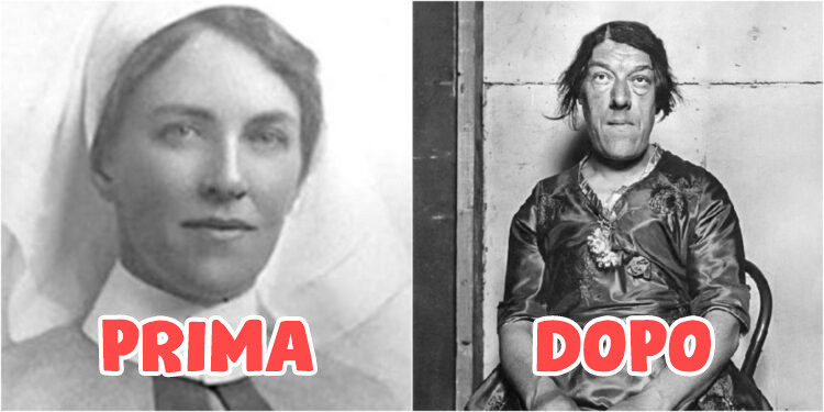 La Storia Della Donna Più Brutta Del Mondo